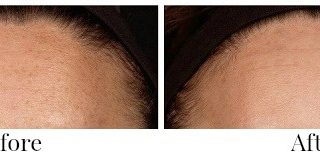 How to Get More Youthful Looking Skin